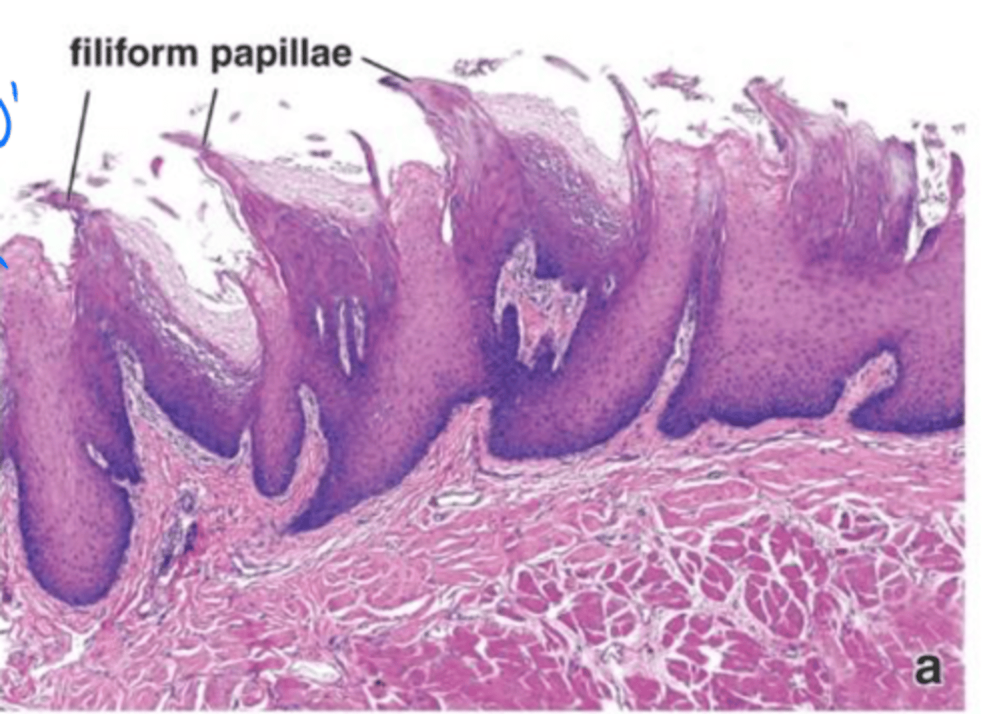 <p>Filiform papillae</p>