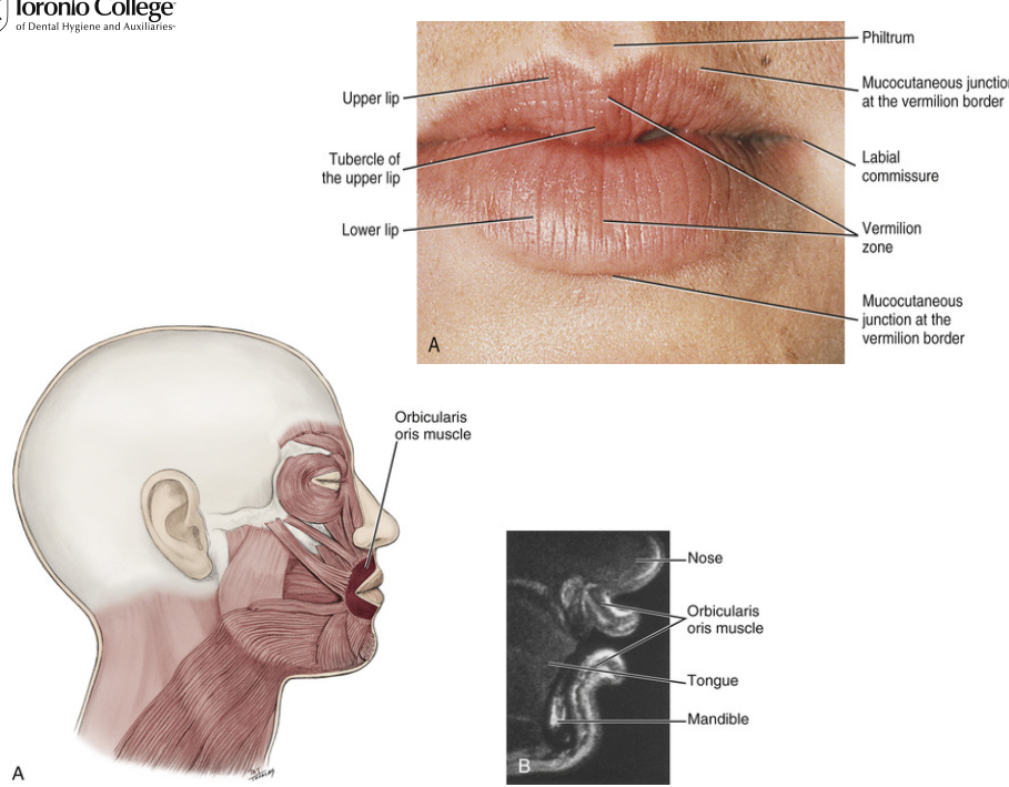 <ul><li><p>Non keratinized squamous epithelium (iinner lips) </p></li><li><p>Lamina propria → contains minor seromucous salivary glands</p></li><li><p>Submucosa → contains<strong> orbicularis oris </strong>muscle </p><ul><li><p>muscle encircles the lips → “kissing muscle” </p></li></ul></li><li><p>Contains eleidin (clear, semi fluid, intracellular protein) </p><ul><li><p>transparent = blood vessels in papillary layer can show through giving lips their colour </p></li></ul></li></ul><p></p>