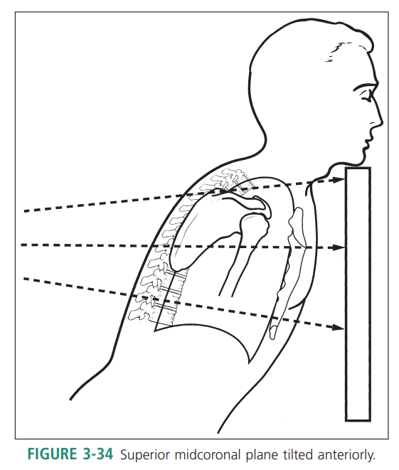<p>Superior midcoronal tilt anteriorly </p>