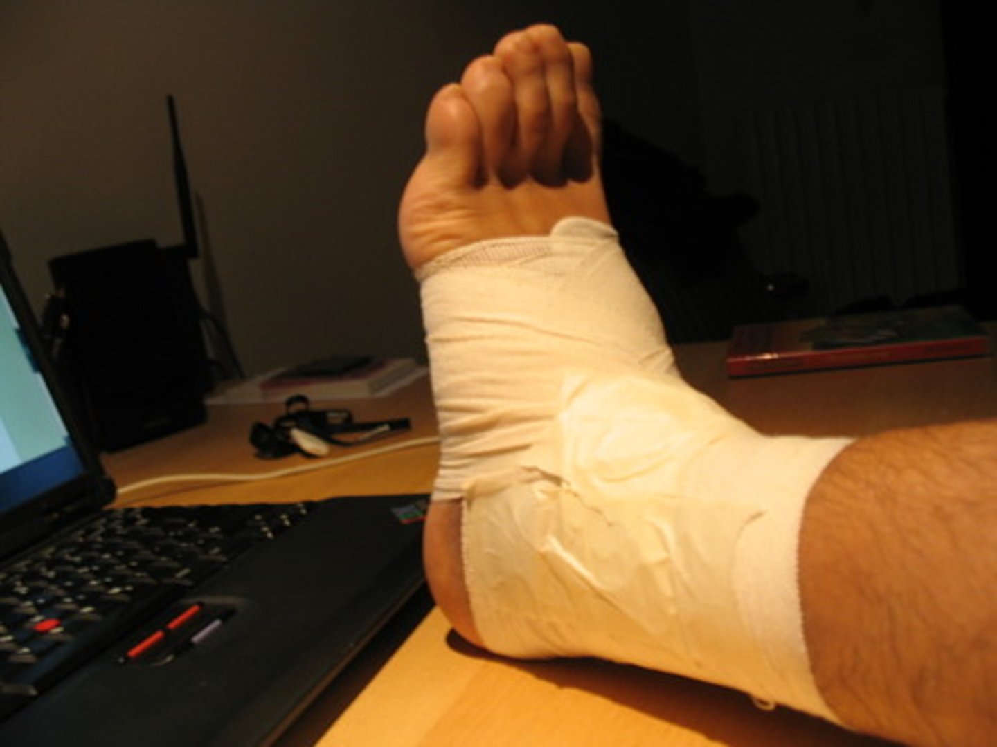 <p>sprained/twisted</p>