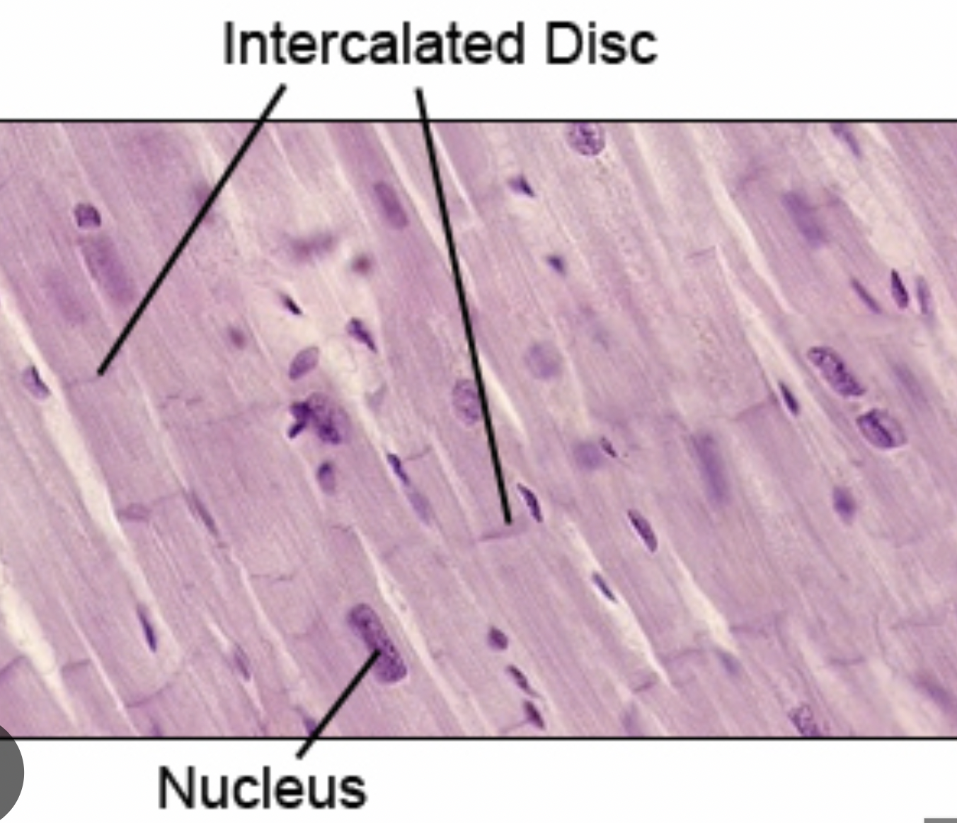 <p>intercalated discs</p>