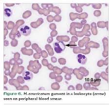 <p>This was found on a blood smear from a dog.</p>