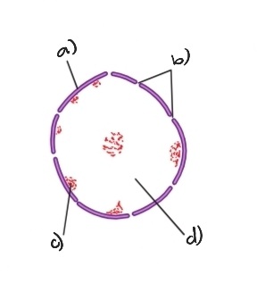 Label the following diagram of the nucleus