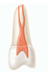 <p><span><strong><span>One canal leaves the pulp chamber and divides short of the apex into two separate, distinct canals with separate apical foramina (1-2)</span></strong></span></p>