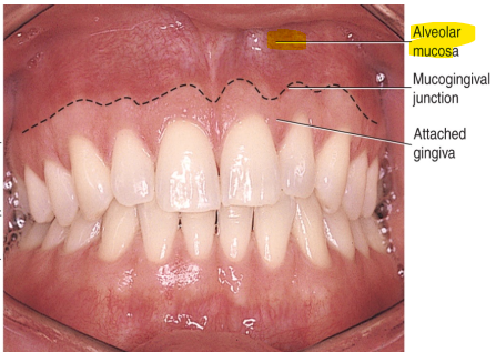 <p>Describe the lining mucosa of Alveolar Mucosa. </p>