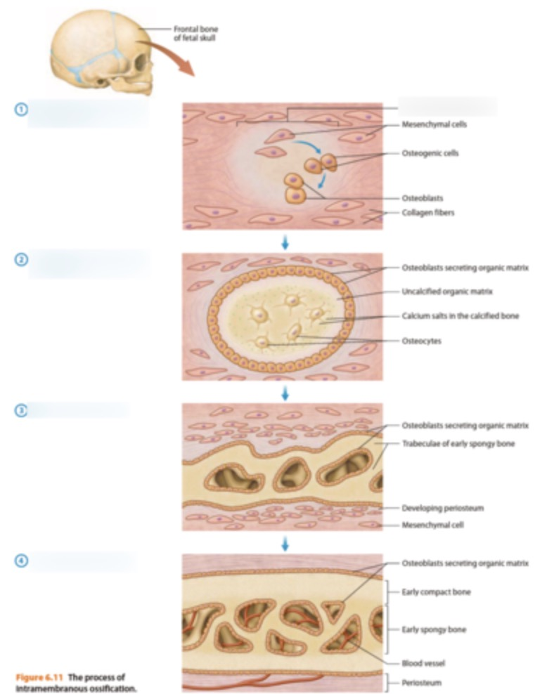 <p><span>En kondensation i mesenkymet</span></p><p></p><p><br><span>1. Osteoprogenitorceller differentierar lokalt</span></p><p><br><span>2. Ossifikationscentra bildas</span><br><br><span>3. Angränsande ossifikationscentra smälter samman</span><br><br><span>4. Mesenkymet som inte genomgår ossifikation ger upphov till endost och periost</span></p><ul><li><p>Mesenkymala celler differentieras till osteoblaster</p></li><li><p><span>vissa osteoblaster utvecklas till osteocyter</span></p></li><li><p><span>olika center bildar spongiöst ben</span></p></li><li><p><span>kompakt ben bildas ytterst av osteocyter</span></p></li><li><p><span>överst bildas benhinnan periostium</span></p></li></ul><p></p>