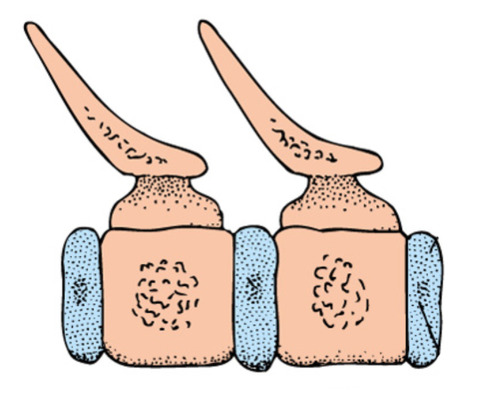 A vertebral articulation in the holospodyl condition characterized by flat ends that resist compressive forces