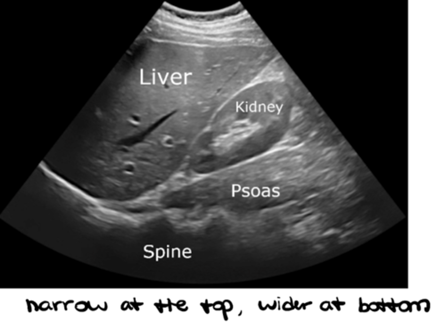 <p>Abdomen, pelvic health, bladder</p>