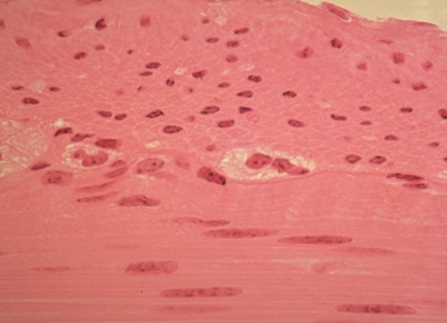 <p>Which is a characteristic of the muscle tissue in this image:</p><p>Cells have an apical and basolateral surface</p><p>Contractile cells that move the extremities</p><p>Contractile cells that squeeze the contents of hollow organs</p><p>Cells produce an extracellular matrix</p>