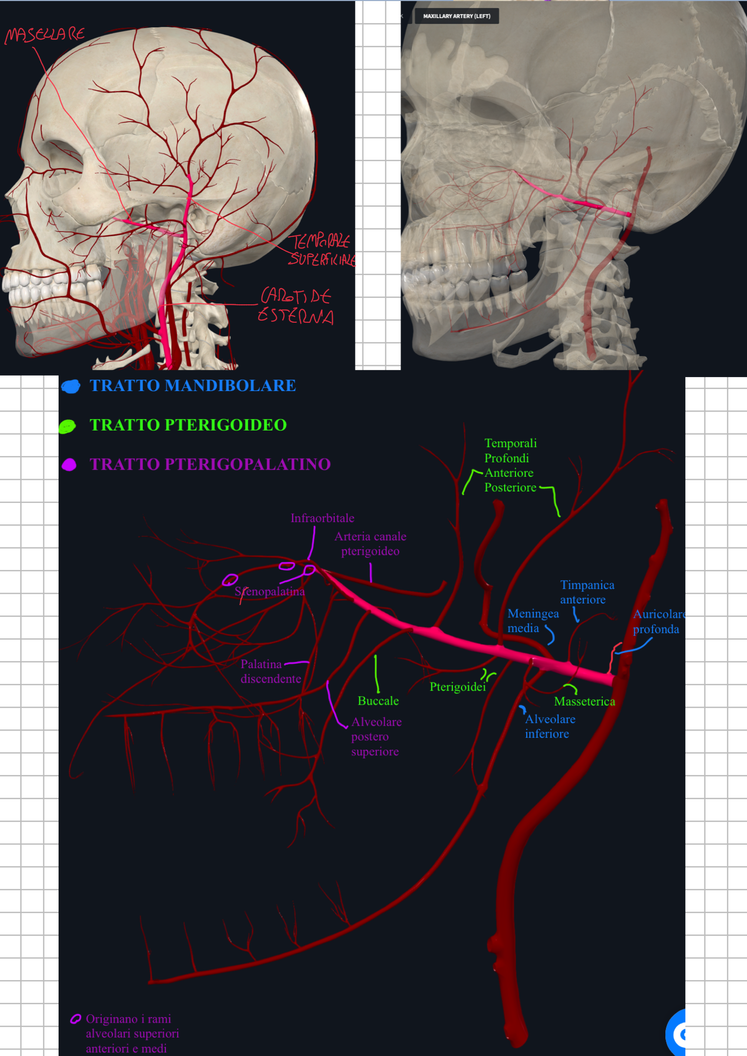 <p>Carotide Esterna:</p><ul><li><p>Emette quindi a livello del collo numerose l’arterie, salendo ancora invece emetterà due altre arterie principali: l’ARTERIA TEMPORALE SUPERFICIALE e l’ARTERIA MASCELLARE</p></li></ul><p>ARTERIA TEMPORALE SUPERFICIALE</p><ul><li><p>Risale anteriormente l’orecchio passando per l’arcata zigomatica (percepibile alla palpazione)</p></li><li><p>Vascolarizza la regione temporale e parte della faccia</p></li><li><p>Da essa origina anche la arteria facciale trasversa.</p></li></ul><p>ARTERIA MASCELLARE</p><ul><li><p>Origina posteriormente alla mandibola per poi passare mediamente al processo condiloideo ed entra nella fossa infratemporale → &nbsp;prosegue profondamente fino alla fossa pterigopalatina dove si divide in &nbsp;3 tratti: MANDIBOLARE - PTERIGOIDEO - PTERIGOPALATINO</p></li></ul><p>Primo Tratto Mandibolare (in ordine):</p><ul><li><p>emette rami per mandibola, orecchio e meningi</p></li><li><p>Arteria Auricolare Profonda e Timpanica Anteriore (per orecchio esterno)</p></li><li><p>Arteria Meningea Media → passa nel foro spinoso dello sfenoide alla fossa cranica media in un decorso aderente alla dura madre → passa per lo pterion, un punto fragile che in causo di trauma può provocare ematoma epidurale (emergenza neurochirurgica)</p></li><li><p>Arteria Alveolare Inferiore → passa nel foro mandibolare ed emette rami per i denti inferiori per poi terminare con il ramo mentale che attraversa il foro mentale.</p></li></ul><p>Secondo Tratto Pterigoideo (in ordine):</p><ul><li><p>Vascolarizza i muscoli della masticazione e strutture adiacenti</p></li><li><p>Arteria Masseterica → per il muscolo massetere</p></li><li><p>Rami Pterigoidei → per i muscoli pterigoidei</p></li><li><p>Temporali Profondi → per il muscolo temporale</p></li><li><p>Arteria Buccale → per il muscolo buccinatore e guancia</p></li></ul><p>Terzo Tratto Pterigopalatino (in ordine):</p><ul><li><p>Entra nella fossa pterigopalatina dove ramifica&nbsp;</p></li><li><p>Arteria Alveolare Postero Superiore → per molari superiori e gengiva </p></li><li><p>Arteria Infraorbitaria → attraversa la fessura orbitaria inferiore → solco, canale e foro infraorbitario per vascolarizzare parte della cavità orbitaria, faccia e denti superiori (con rami alveolari superiori anteriori e medi)</p></li><li><p>Arteria Palatina Discendente → entra nel canale palatino maggiore (tra sfenoide e palatino) dividendo in arteria palatina maggiore e minori per vascolarizzare palato duro e molle</p></li><li><p>Arteria del Canale Pterigoideo → verso la faringe</p></li><li><p>Arteria Sfenopalatina → attraversa il foro sfenopalatino per vascolarizzate la cavità nasale</p></li></ul><p></p><p></p>