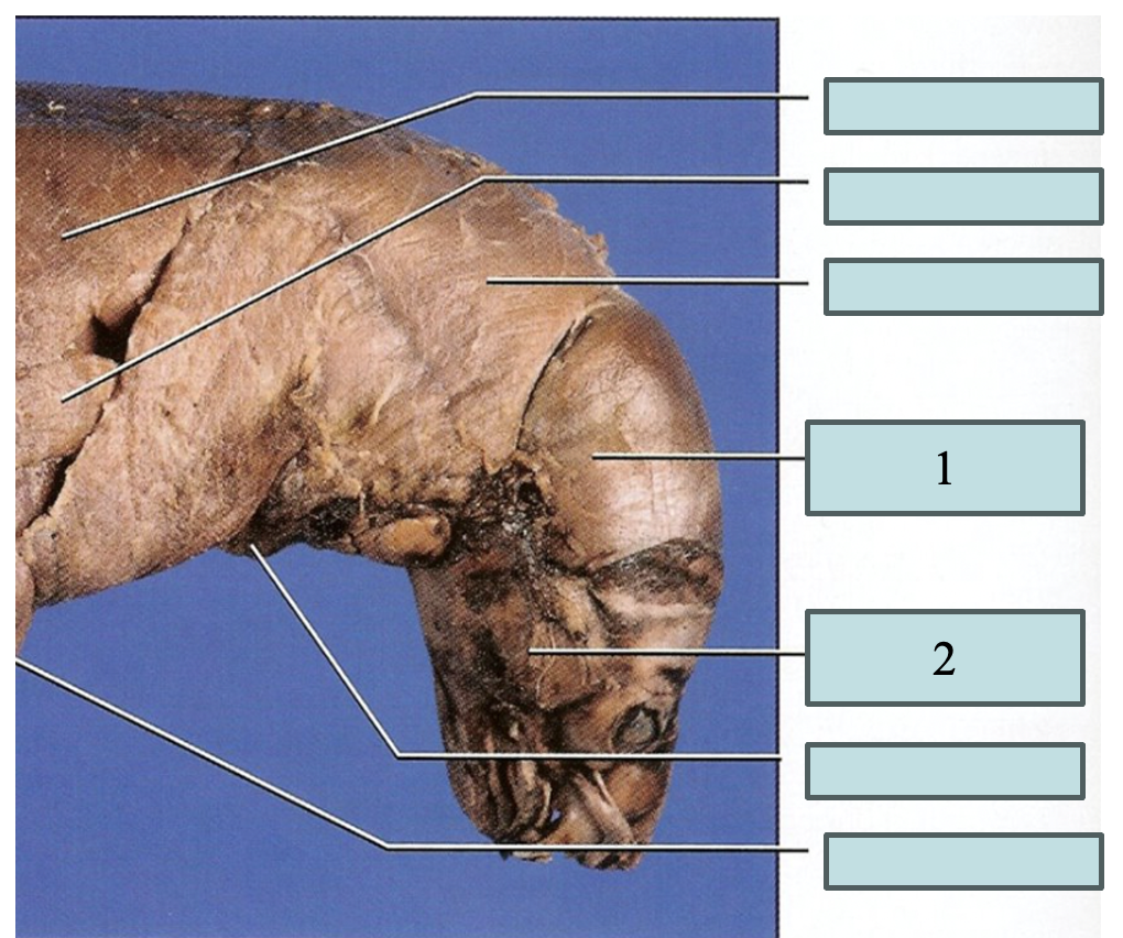 <p>what is 1?</p>