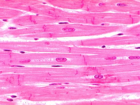 <p>Cardiac Muscle</p>