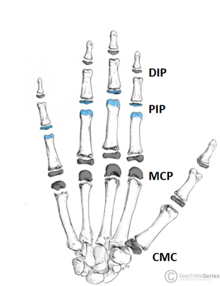 <p>Proximal Interphalangeal Joint (PIP) (Enter-fuh-lan-Gee-ul)</p>