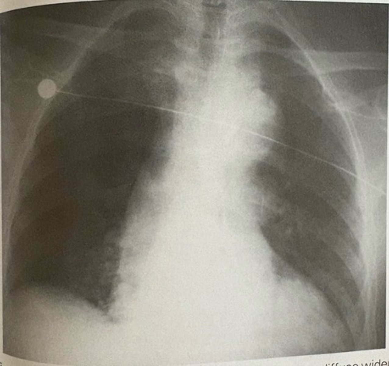 <p>what pathology is present?</p>