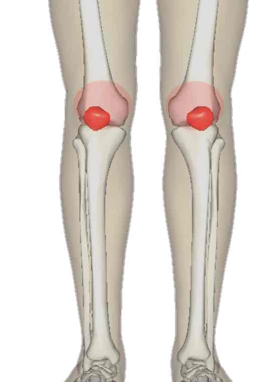 <p><span>The anterior of the knee</span></p>