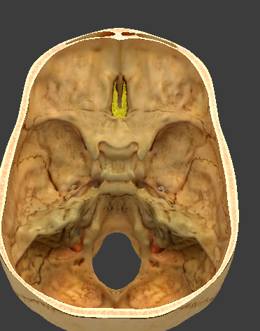 term image