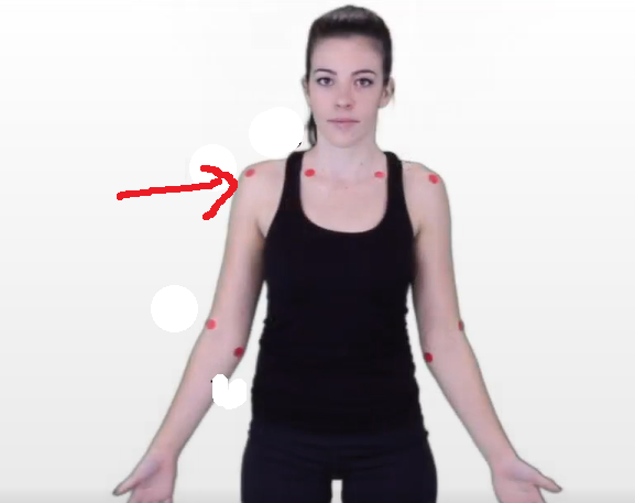 <p>The dermatomal area where the arrow is pointing would indicate what level? </p>