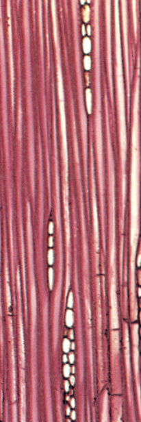 <ul><li><p>fibers (slight flexibility while being sturdy)</p></li><li><p>sclerids</p></li></ul><p></p>