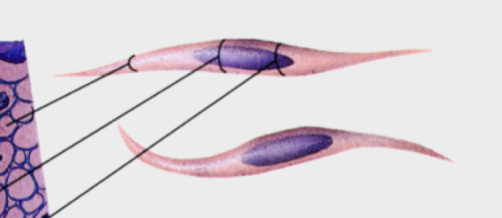 <p>fusiform shape </p>