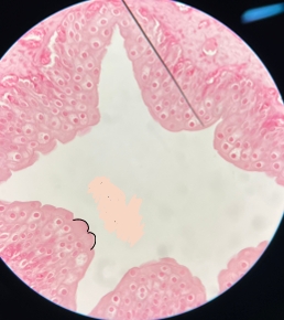<p>ureter - h&amp;e </p>