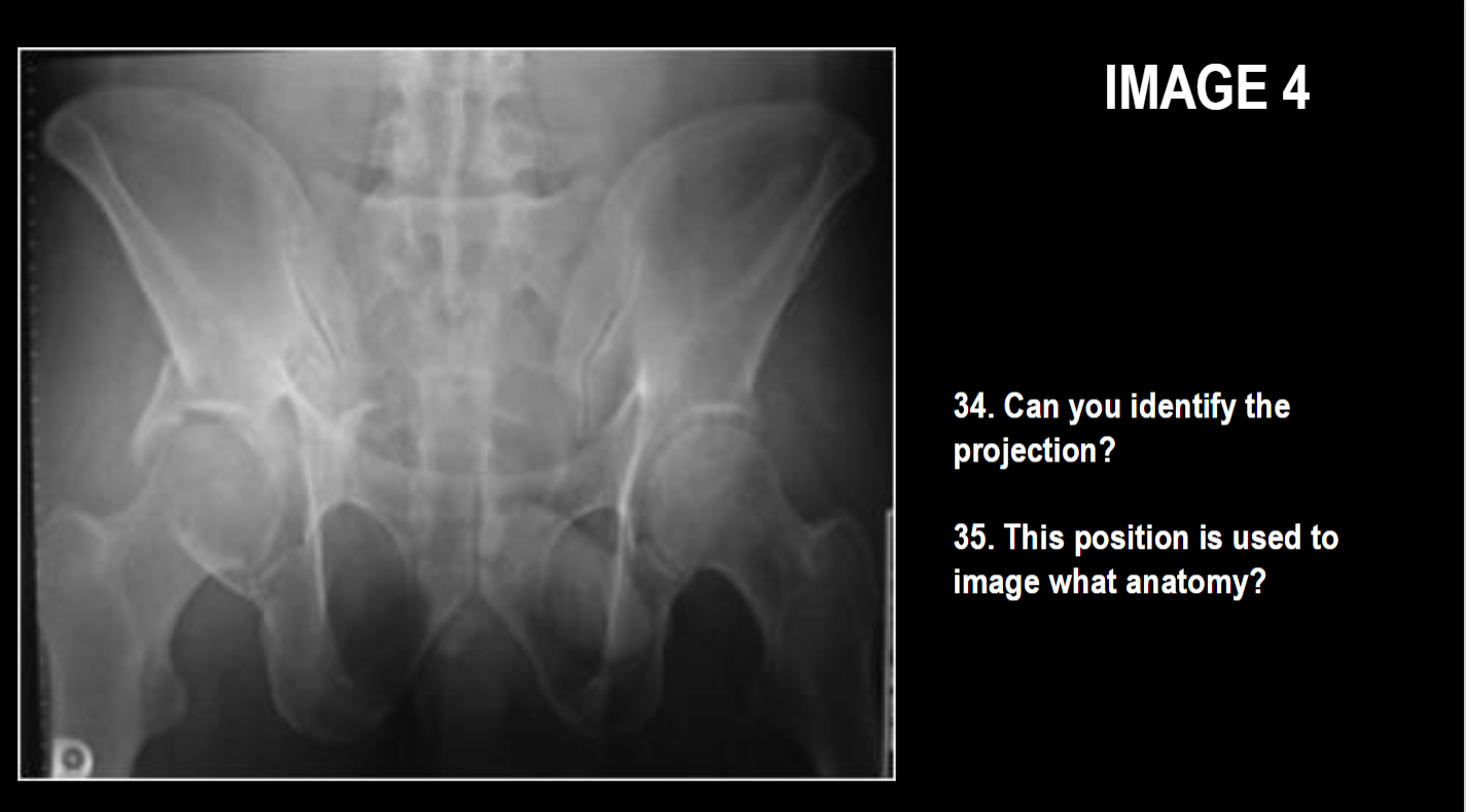 <p><span><span>This position is used to</span><span><br></span><span>image what anatomy?</span></span></p>