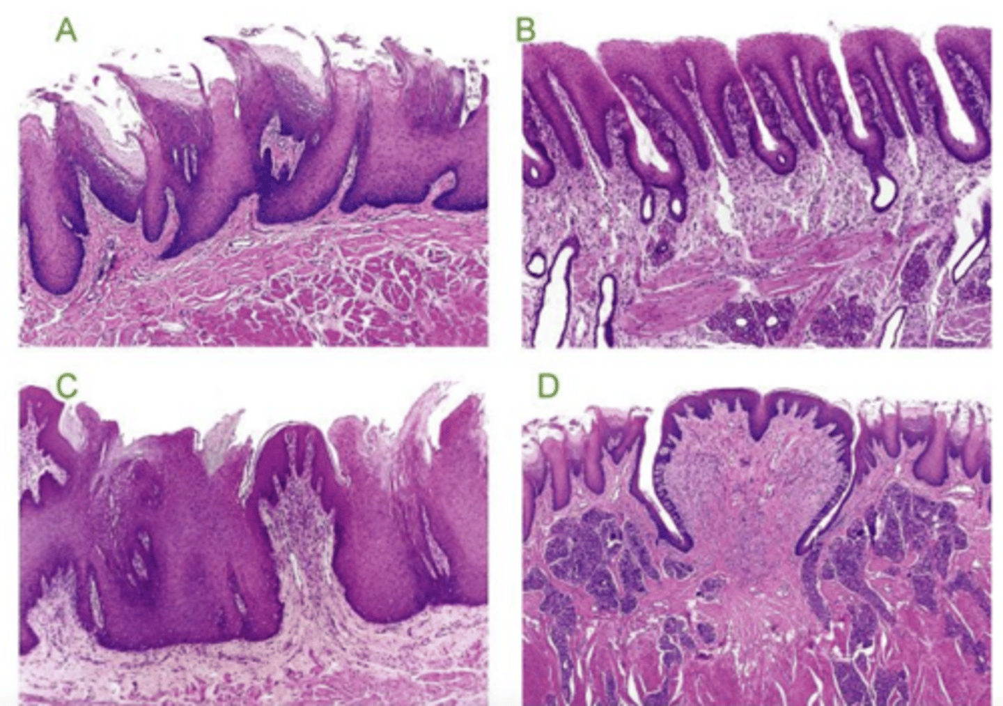 <p>which is fungiform papillae?</p>