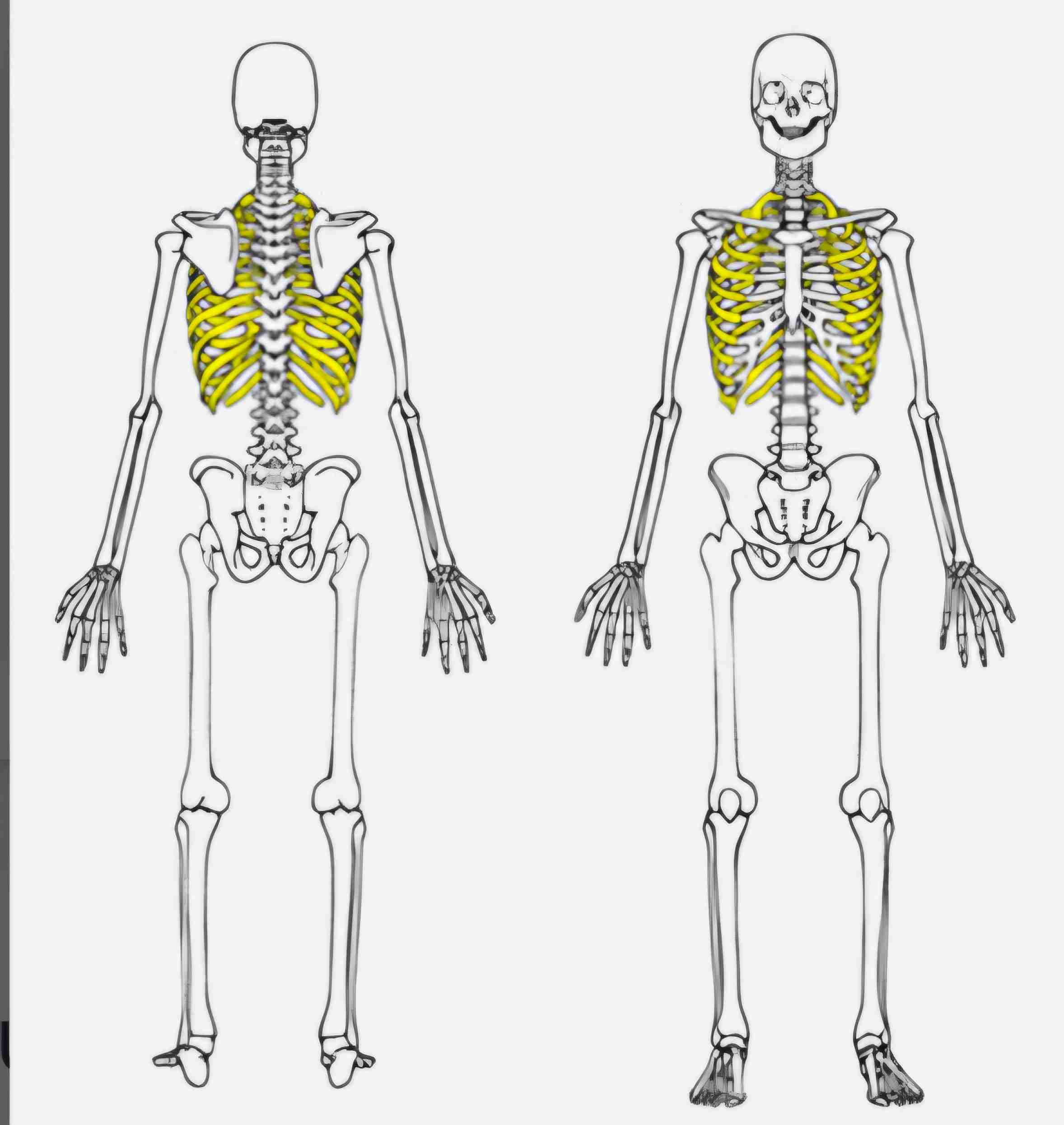 <p>What bone is this?</p>