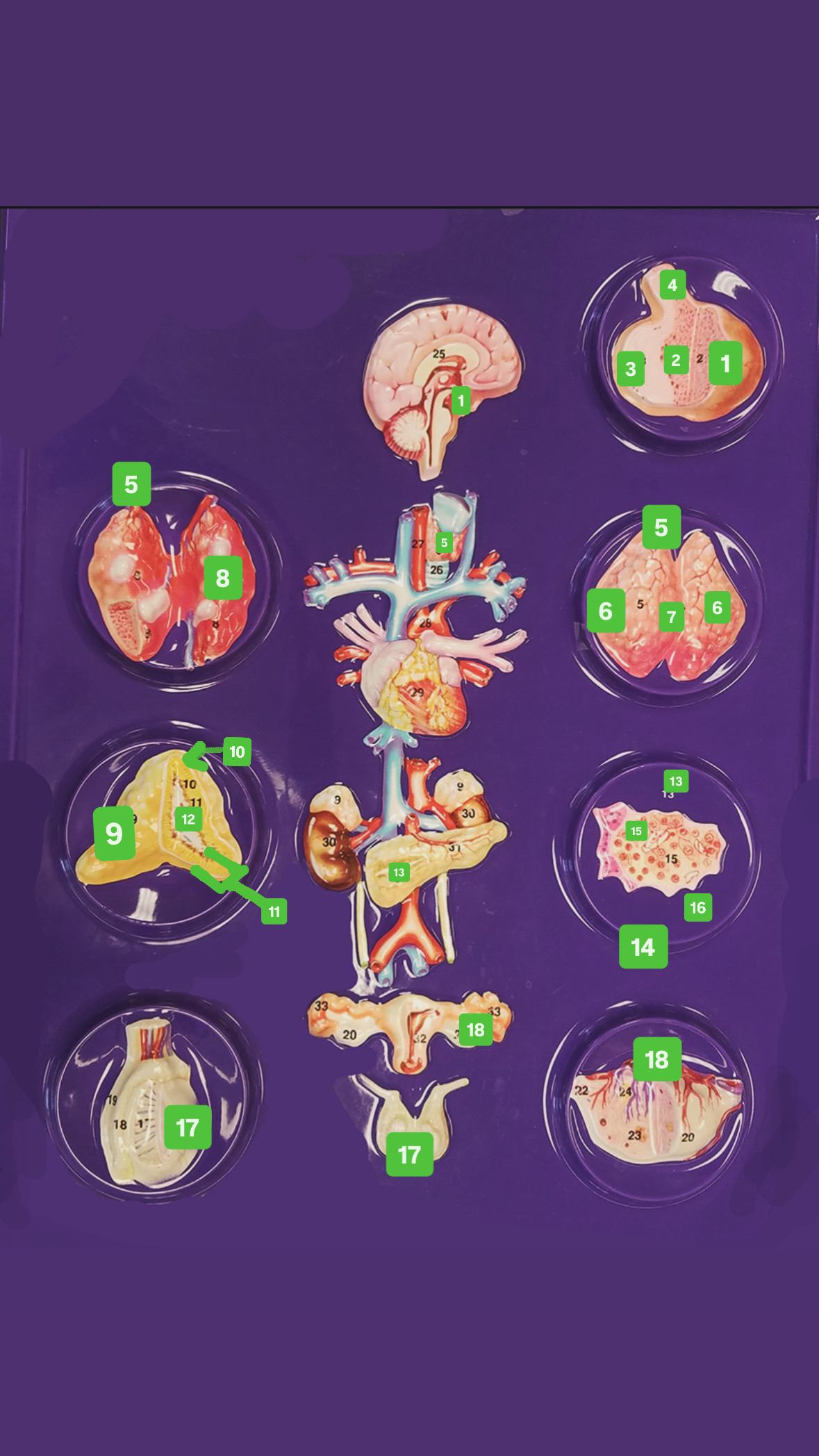 <p>Pituitary Gland (2 Places)</p>