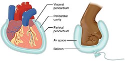 <p>A thin tissue that lines body cavities and organs in the chest and abdomen, including the stomach </p>