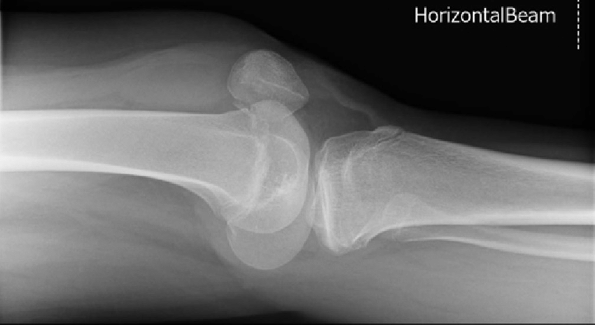 <p>What kind of rotation is this?</p>
