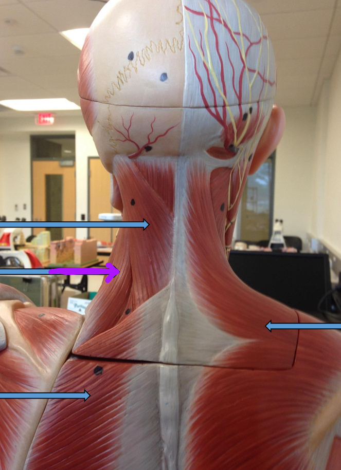 <p>Identify this muscle?</p>