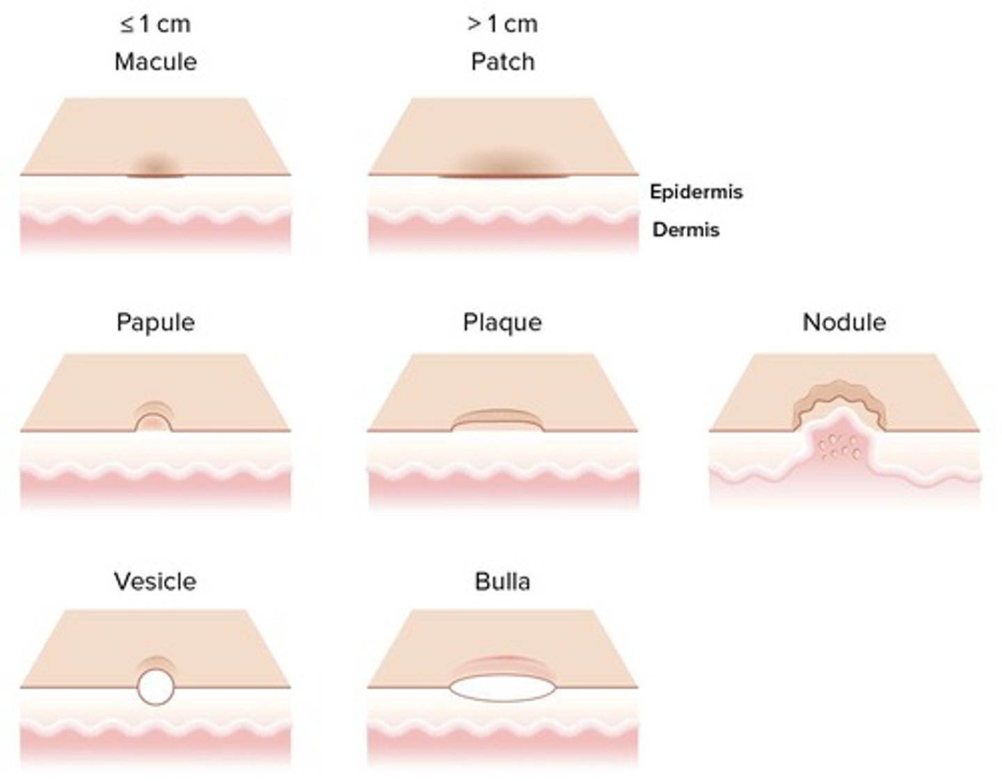 <p>Nonpalpable, palpable/solid, or palpable/fluid-filled lesions</p>