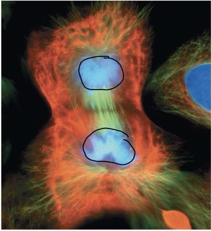 <p>Telophase</p>
