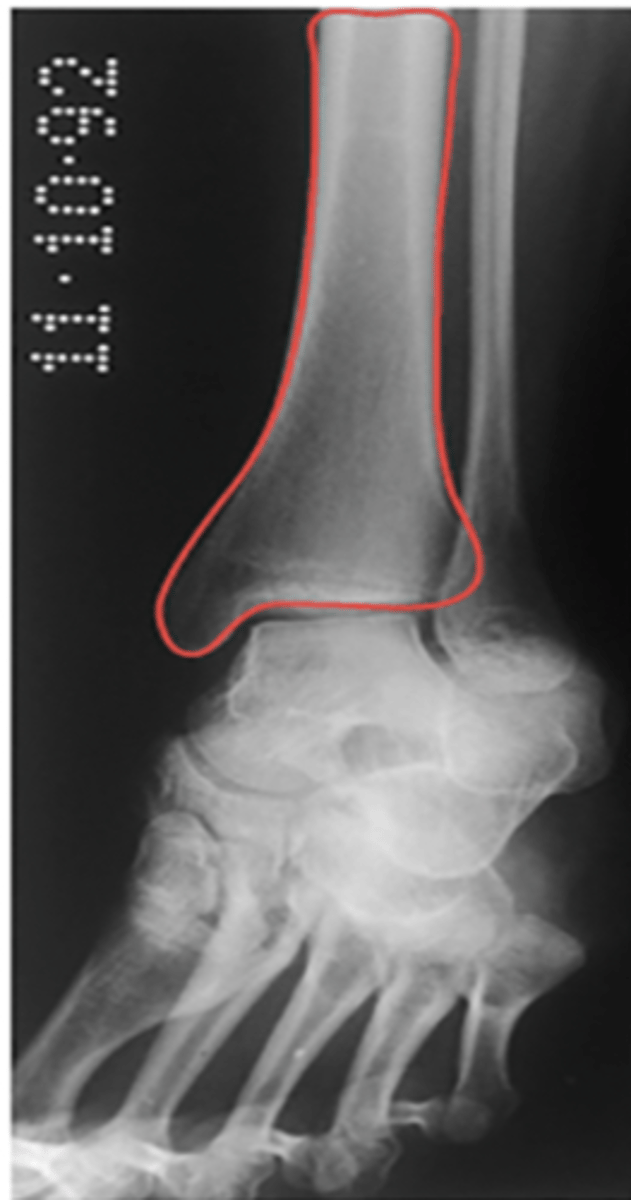 <p>What structure is highlighted?</p>