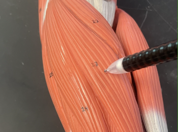 <p>What is the pen pointing at?</p>