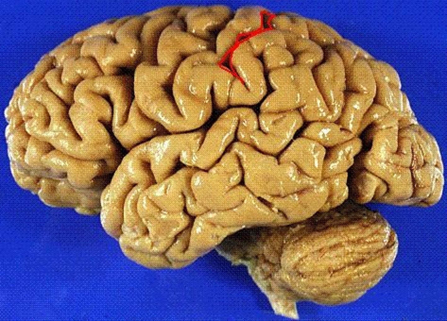 <p>creates posterior border of the sensory cortex</p>