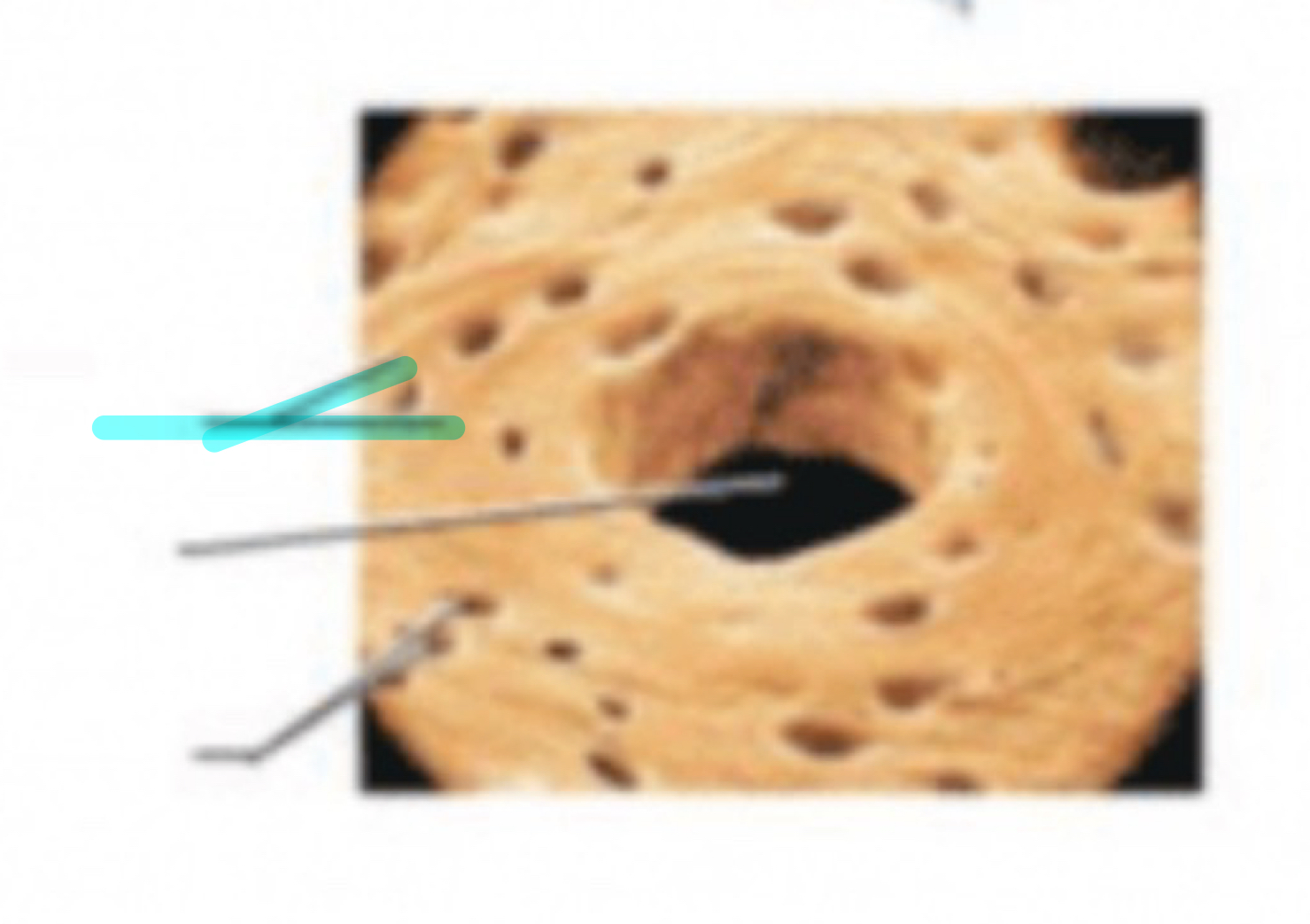 term image