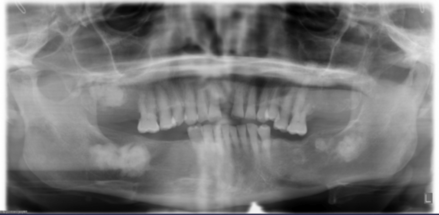 <p>How would you describe the lesion?</p>