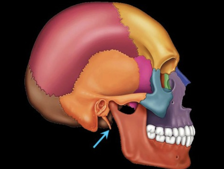 term image