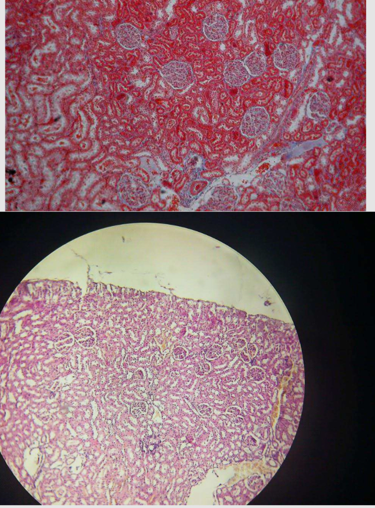 <p>Kidney</p>