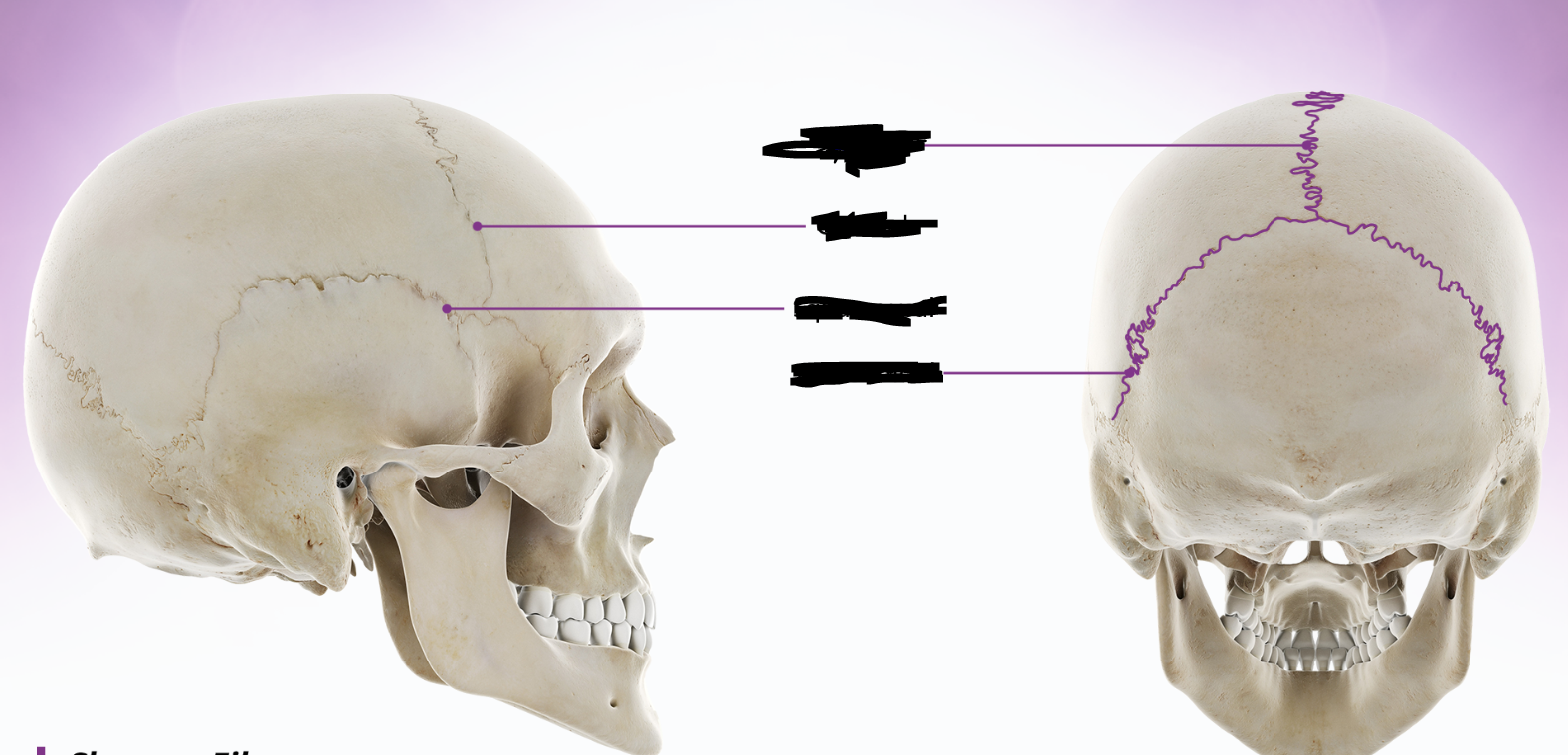 <p>sutures</p>