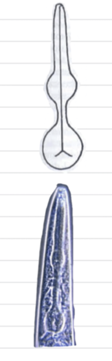 <p>what type of esophagus is this?</p>