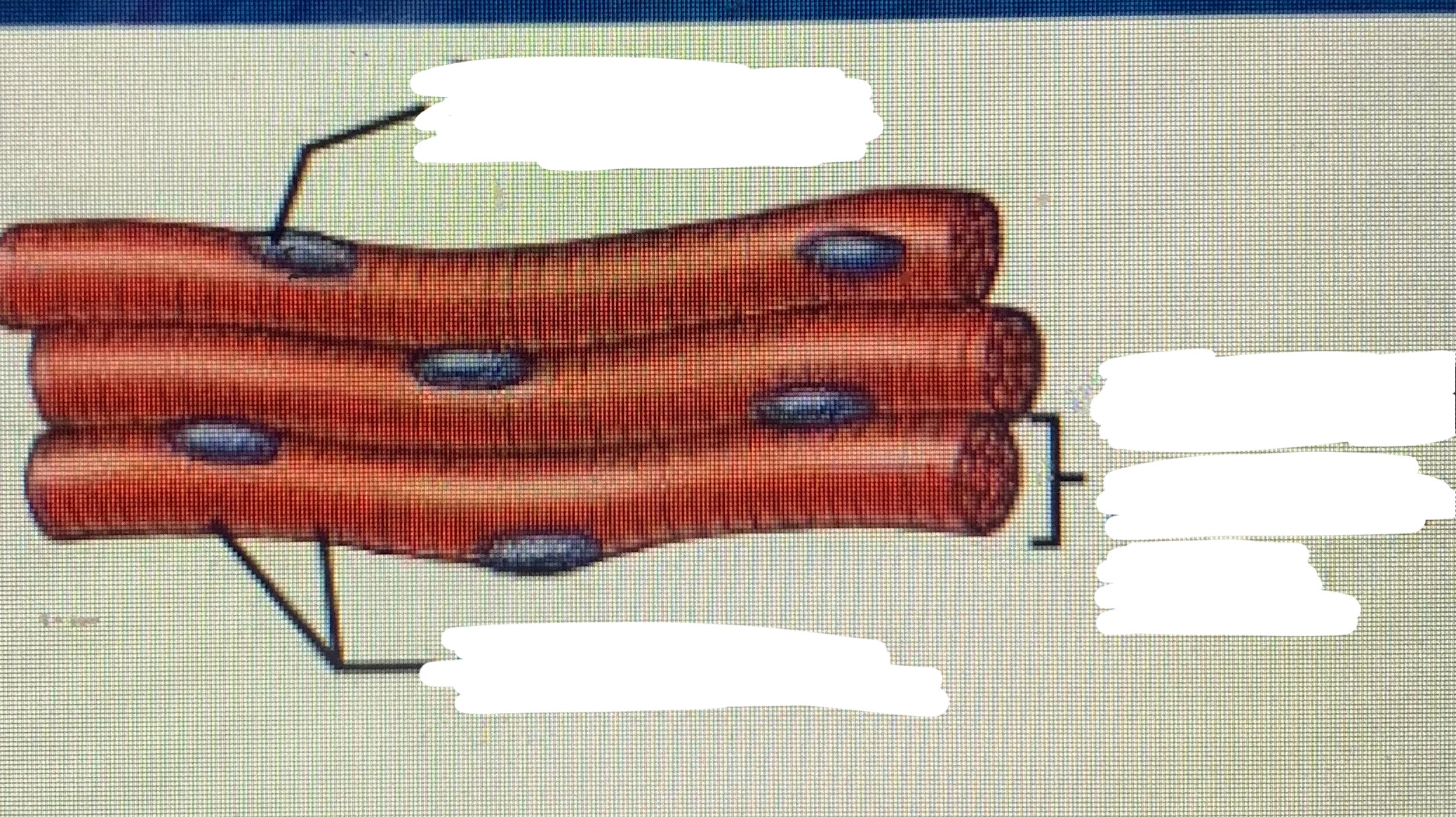 <p>Name the muscle</p>