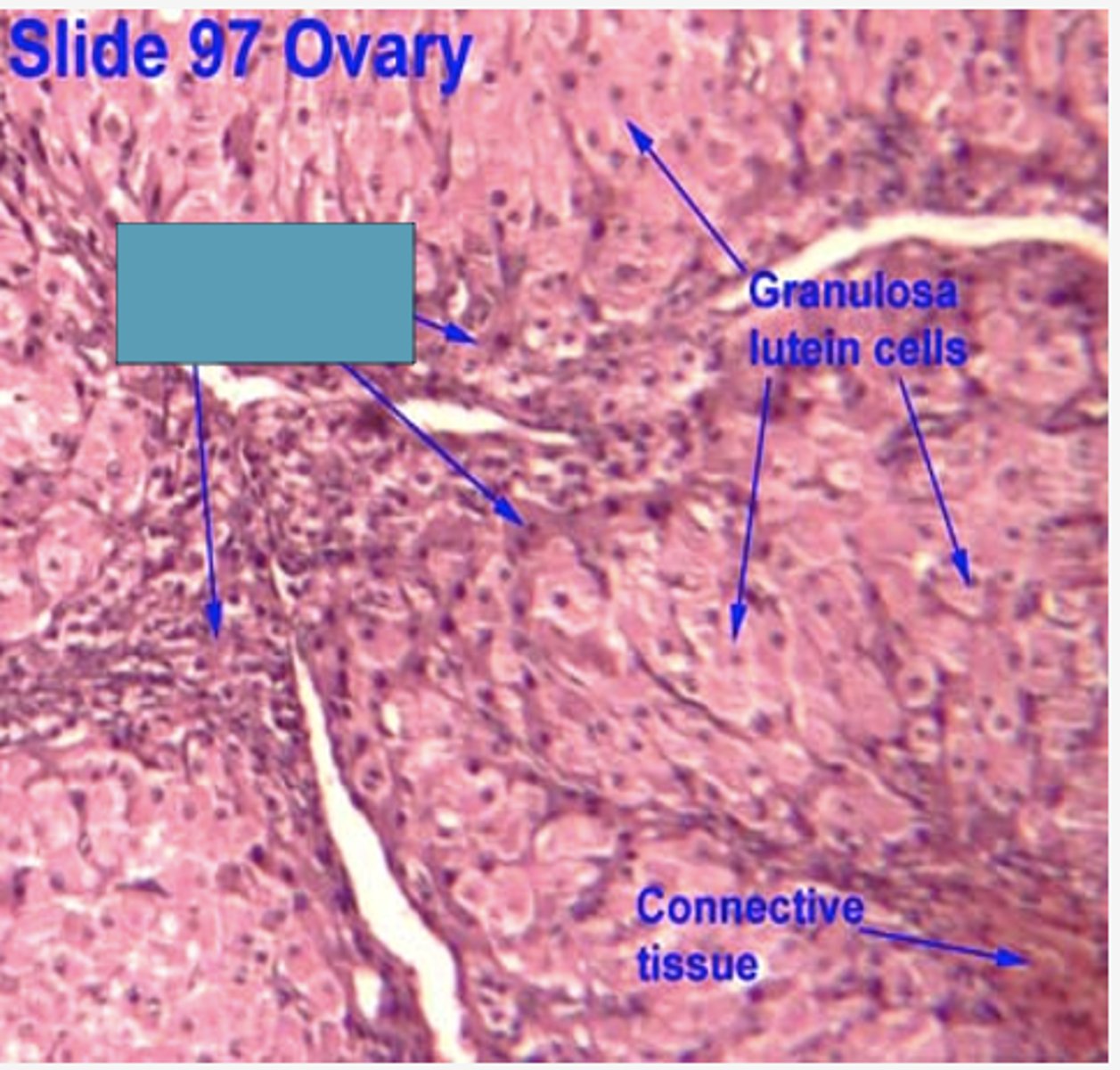 <p>Identify the cells</p>