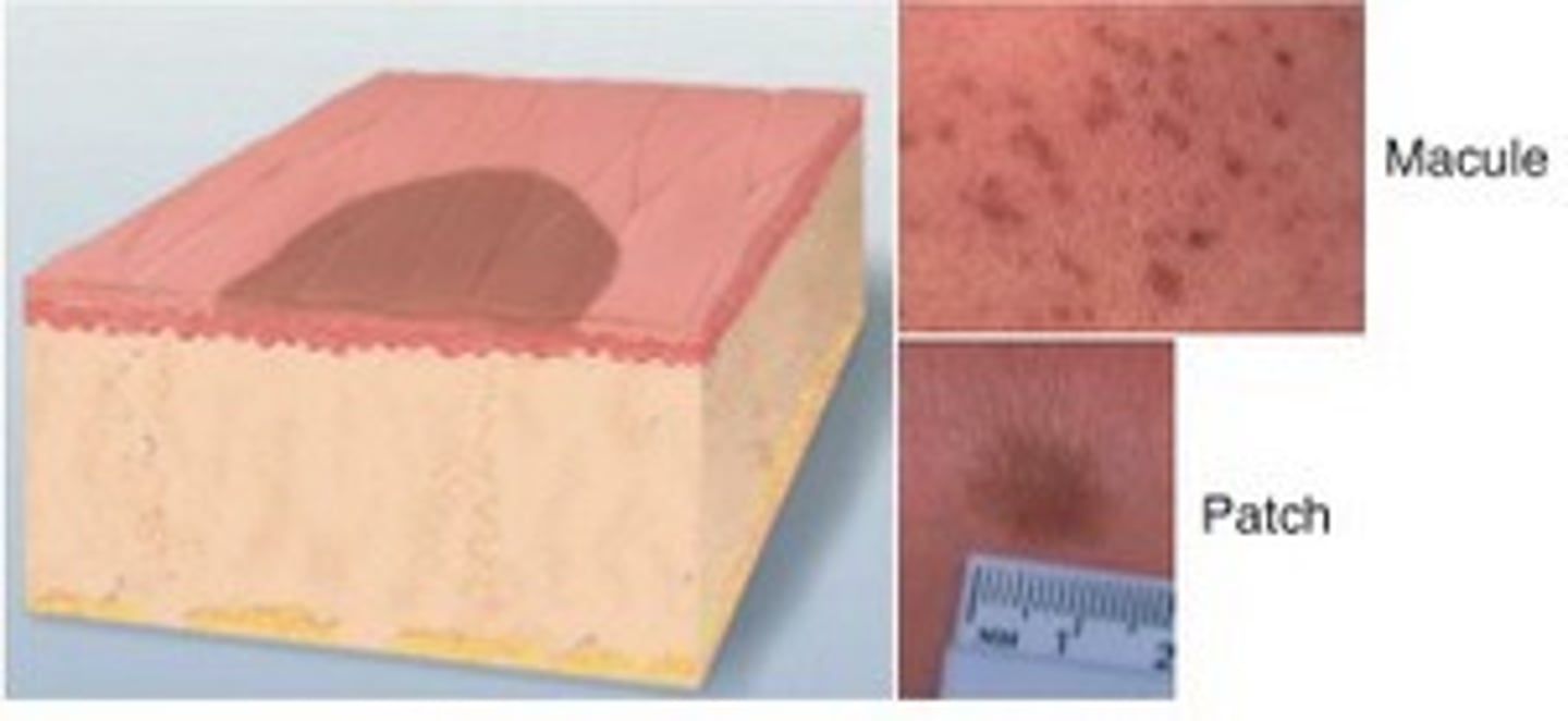 <p>Macule: <1 cm, flat, circumscribed</p><p>Patch: > 1 cm</p>