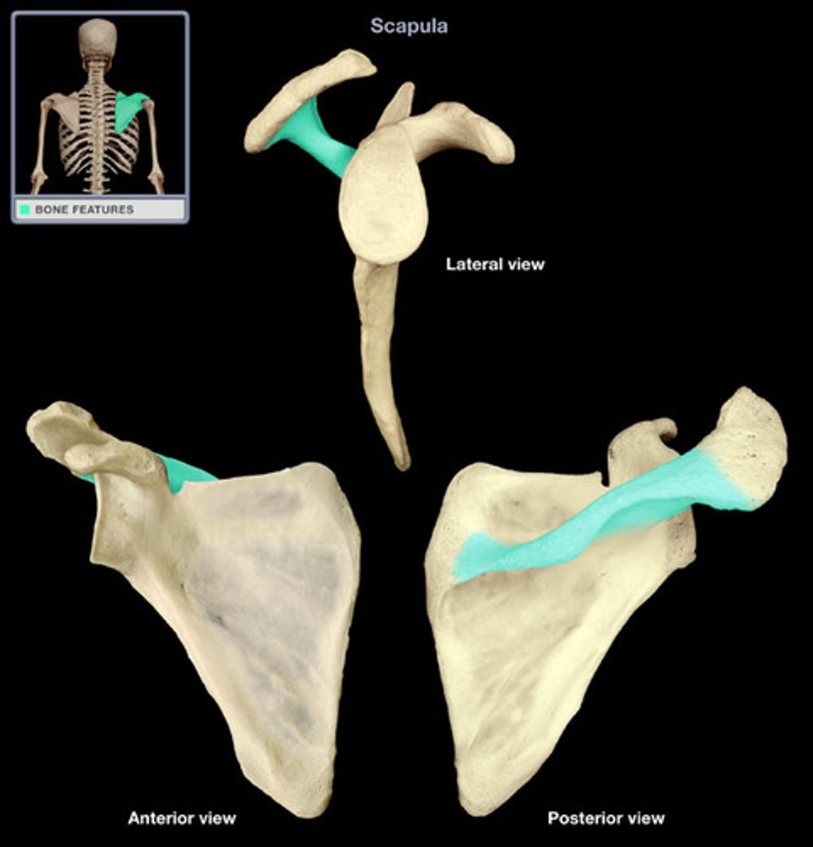 <p>Prominent ridge running horizontally along the posterior aspect of the scapula, dividing it into supraspinatus and infraspinatus fossae.</p>
