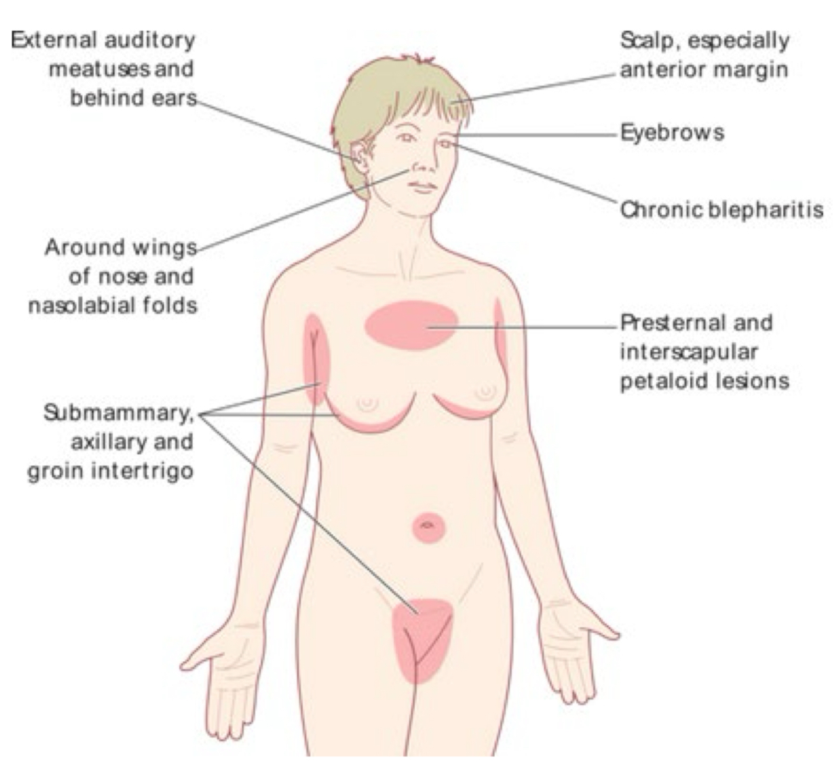 <p>what type of distribution</p>