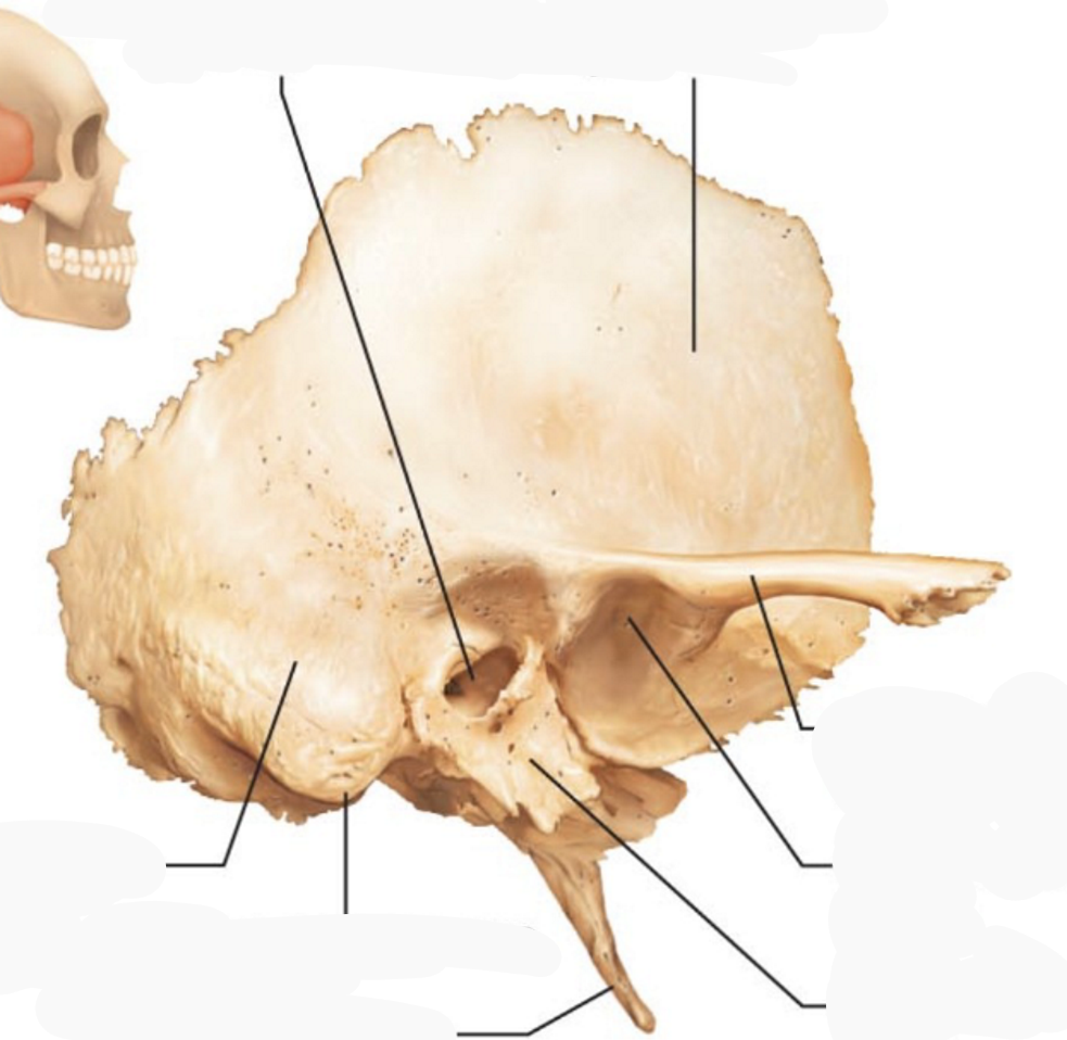 <p>Where in the picture is the zygomatic process of squamous part of the temporal bone?</p>