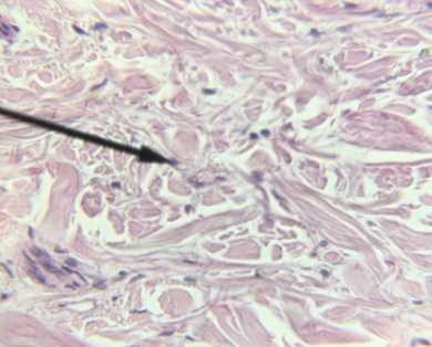 <p>what kind of tissue is this </p>