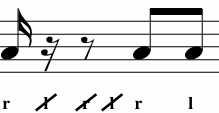 <p>What Variation is This? </p>